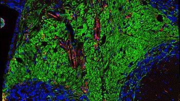 DemyelinatinCerebellum_cell350
