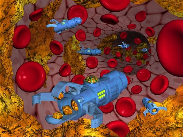 arteryHiRes640