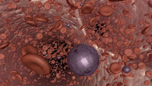 respirocyte