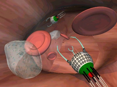 botinvein